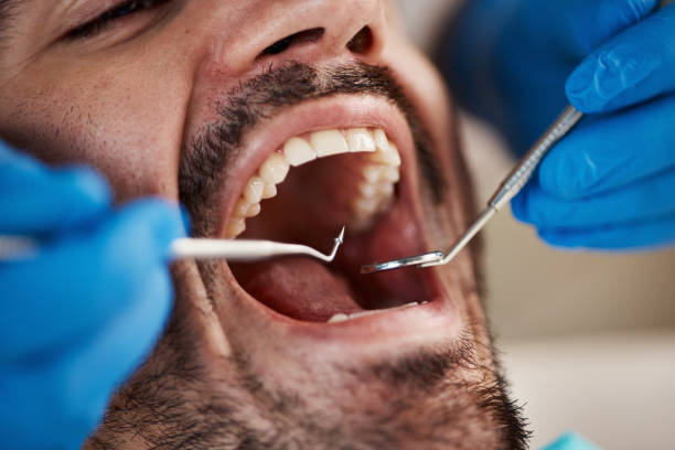 Best Emergency Tooth Extraction in Martsville, IN